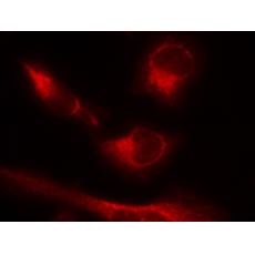 兔抗MAPT (Phospho-Ser356)多克隆抗体