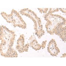 兔抗PBXIP1多克隆抗体