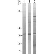 兔抗PTGR2多克隆抗体