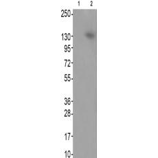 兔抗MAP3K1(Phospho-Thr1402)多克隆抗体
