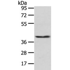 兔抗PHKG1多克隆抗体