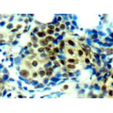 兔抗MAPK1 MAPK3 (Phospho-Thr185 202)多克隆抗体