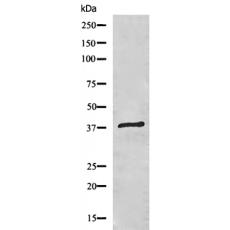 兔抗MT-ND2多克隆抗体
