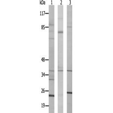 兔抗SLC25A31多克隆抗体