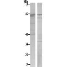 兔抗PRKCA(Ab-657)多克隆抗体