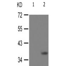 兔抗NFKBIB(Phospho-Thr19)多克隆抗体