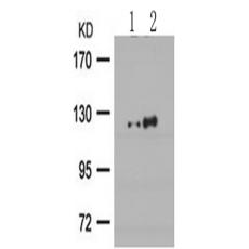 兔抗PRKD1 (Phospho-Ser738)多克隆抗体