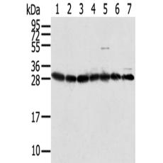 兔抗RPS3多克隆抗体 