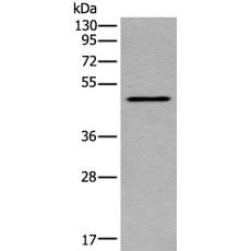 兔抗TRDMT1多克隆抗体