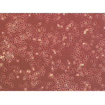 大鼠原代Ⅱ型肺泡上皮细胞