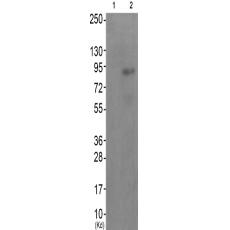 兔抗MUSK(Phospho-Tyr755)多克隆抗体
