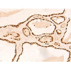 兔抗METTL1多克隆抗体