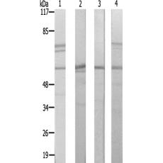 兔抗PFKFB1多克隆抗体