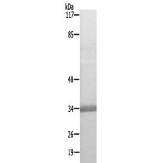 兔抗NFKBIA(Ab-3236)多克隆抗体