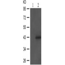 兔抗MAPK14 (Phospho-Thr180 Tyr182)多克隆抗体