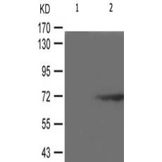 兔抗RPS6KB1(Phospho-Ser371)多克隆抗体