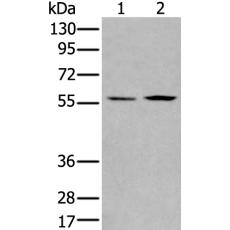 兔抗PGBD2多克隆抗体