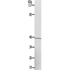  兔抗RPS6KB2(Ab-423) 多克隆抗体 
