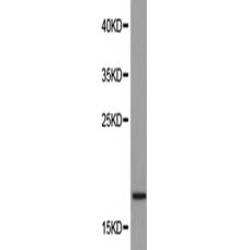 兔抗RNASE1多克隆抗体  