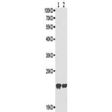 兔抗RNASE13多克隆抗体  