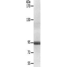兔抗NR3C1(Ab-211)多克隆抗体