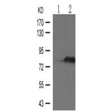 兔抗PRKCB (Phospho-Thr641)多克隆抗体