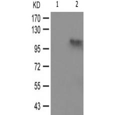 兔抗PRKD123(Phospho-Ser738742)多克隆抗体