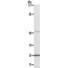 兔抗PLAGL1多克隆抗体