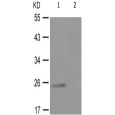 兔抗TK1(Phospho-Ser13) 多克隆抗体 