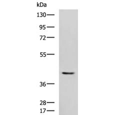 兔抗STK32A多克隆抗体  