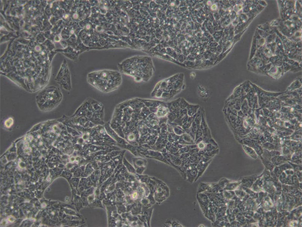 GFP标记的小鼠子宫颈癌细胞