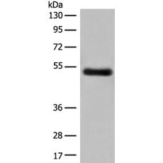 兔抗GK5多克隆抗体   