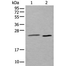 兔抗UBE2T多克隆抗体  
