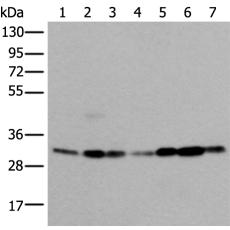  兔抗VDAC1多克隆抗体 