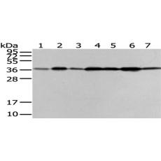 兔抗VPS26A多克隆抗体 