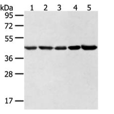 兔抗WDR77多克隆抗体   