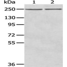 兔抗WNK2多克隆抗体 