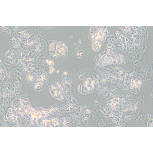 MDA-MB-175VII人乳腺导管癌细胞(L15)