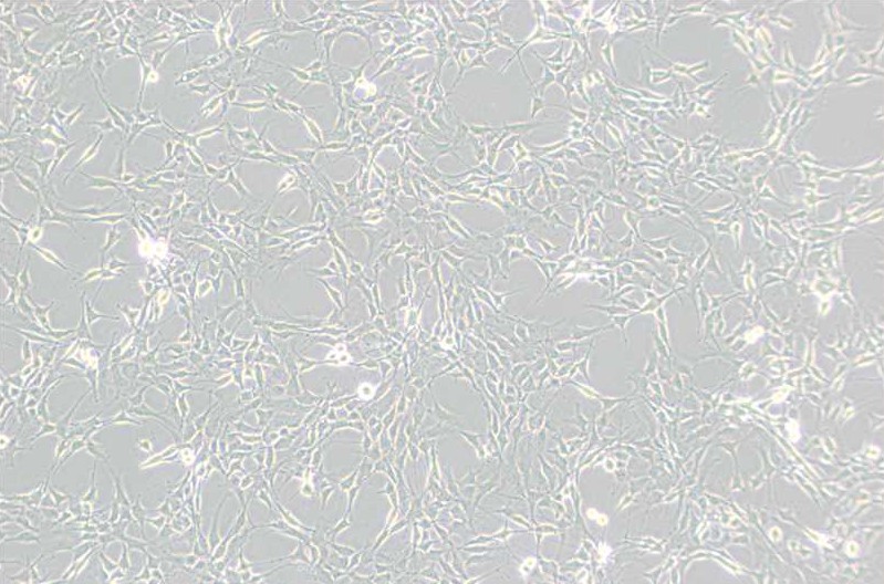 RG2[D74]大鼠胶质瘤细胞
