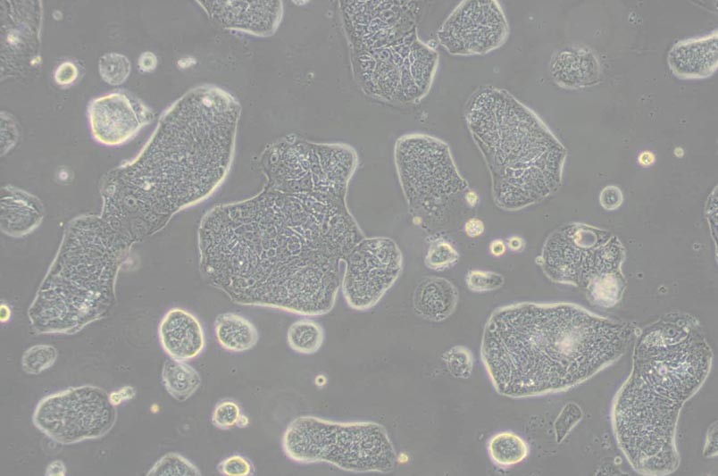 SW1116人结肠腺癌细胞(L15)