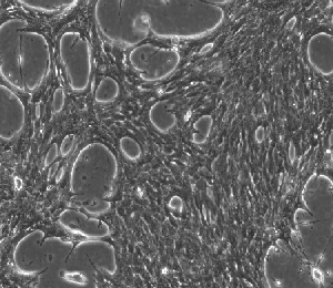 HEP-53.4 小鼠肝癌细胞